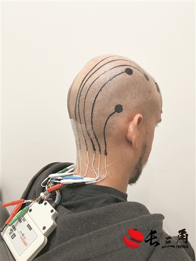 媒体管家： “电子墨水”可监测脑电波 有望拓展非侵入式脑机接口技术应用